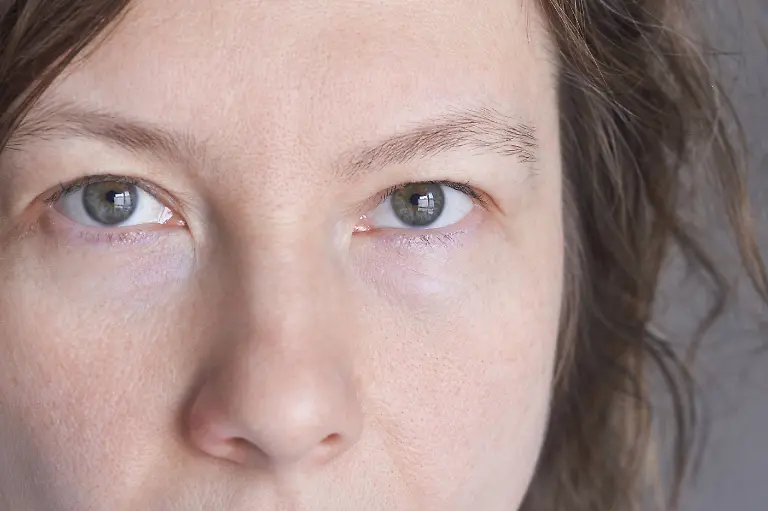Nahaufnahme-eines-Frauenportraets-das-beide-Augen-die-Hautstruktur-und-einen-neutralen-Gesichtsausdruck-zeigt-Nahaufnahme-eines-Frauenportraets-das-beide-Augen-die-Hautstruktur-und-einen-neutralen-Gesichtsausdruck-zeigt-LicenseRF-model-released-Symbolfoto-Copyright-xZoonar