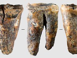 Schmerzhafter Eingriff: Studie: Neandertaler kannten bereits Zahnärzte
