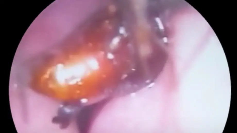 Video poster