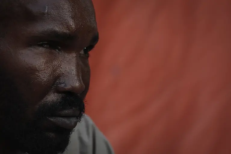 Mohamed-Adam-38-a-Sudanese-refugee-from-Al-Fashir-looks-on-during-an-interview-with-Reuters-amid-ongoing-conflict-in-Sudan-between-the-paramilitary-Rapid-Support-Forces-RSF-and-the-Sudanese-army-as-he-recovers-at-a-friend-s-house-in-the-city-of-Tine-eastern-Chad-November-23-2025-REUTERS-Amr-Abdallah-Dalsh-TPX-IMAGES-OF-THE-DAY-SEARCH-ABDALLAH-DALSH-SUDAN-SURVIVORS-FOR-THIS-STORY-SEARCH-WIDER-IMAGE-FOR-ALL-STORIES