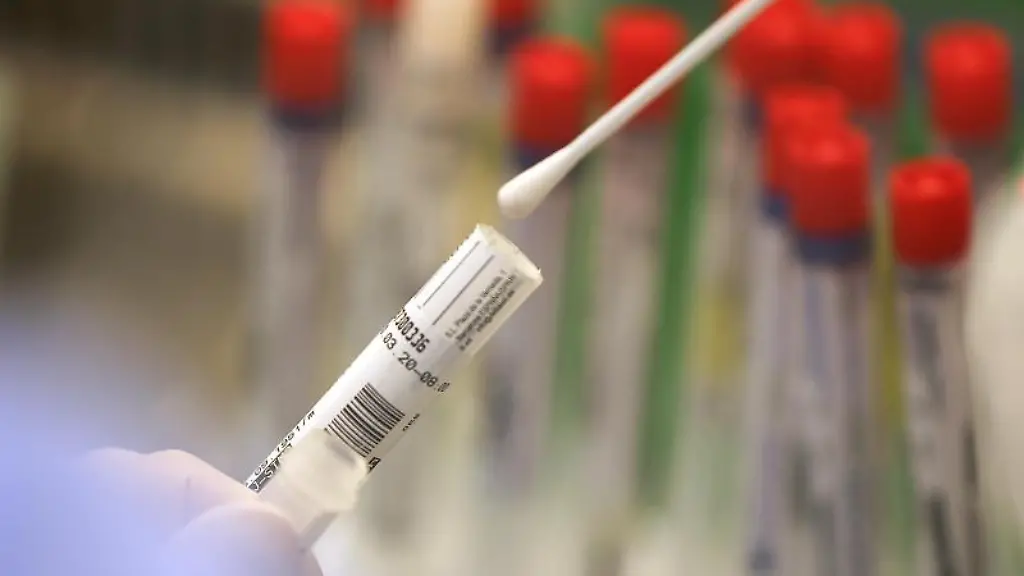 Ein-Wattestaebchen-mit-einem-Abstrich-wird-im-Labor-fuer-einen-Corona-Test-verarbeitet