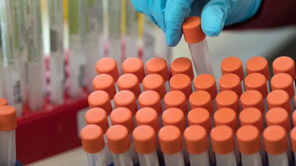 Proben-fuer-Corona-Tests-werden-fuer-die-weitere-Untersuchung-vorbereitet