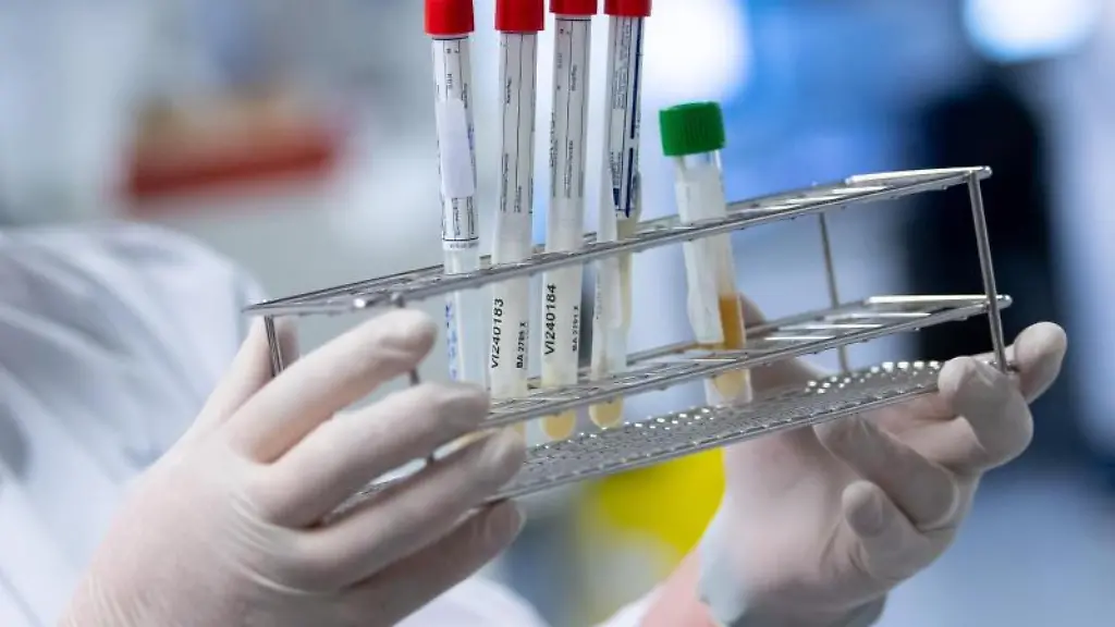 Eine-Laborantin-bereitet-Proben-fuer-Corona-Tests-fuer-die-weitere-Analyse-vor