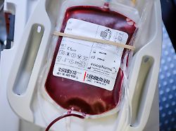 Alter ist nicht ausschlaggebend: Nicht jeder darf Blut spenden