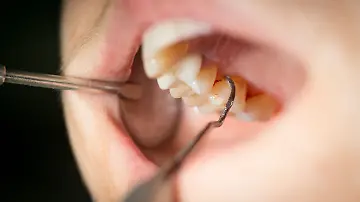 64966916