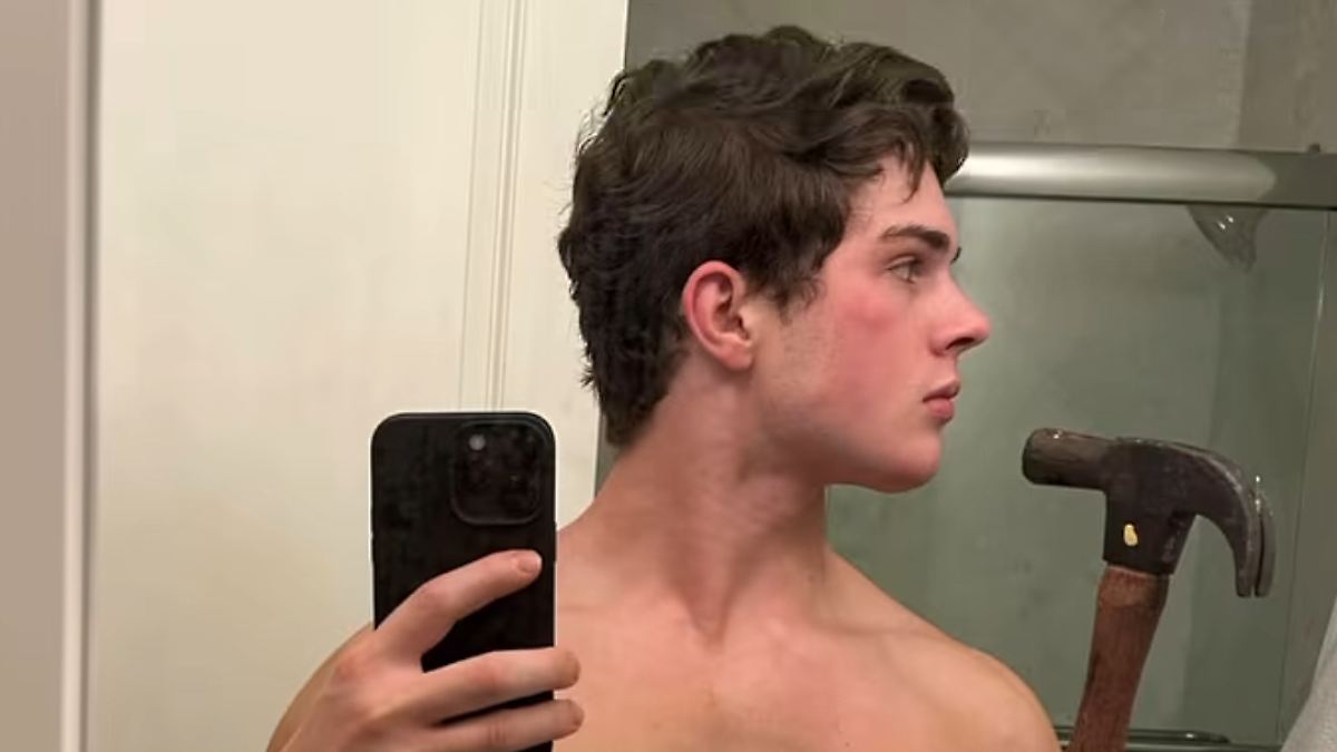 Alpha-Bros-mit-Rechtsdrall-Spritze-in-den-Penis-Hammer-ins-Gesicht-was-ist-Looksmaxxing-