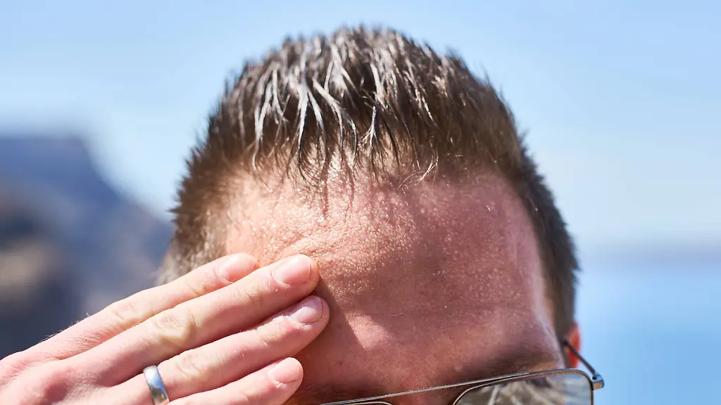 Santorini-Greece-May-8-2024-Sweating-man-on-a-summer-day-wipes-the-beads-of-sweat-from-his-forehead-Schwitzender-Mann-an-einem-Sommertag-wischt-sich-die-Schweissperlen-von-der-Stirn