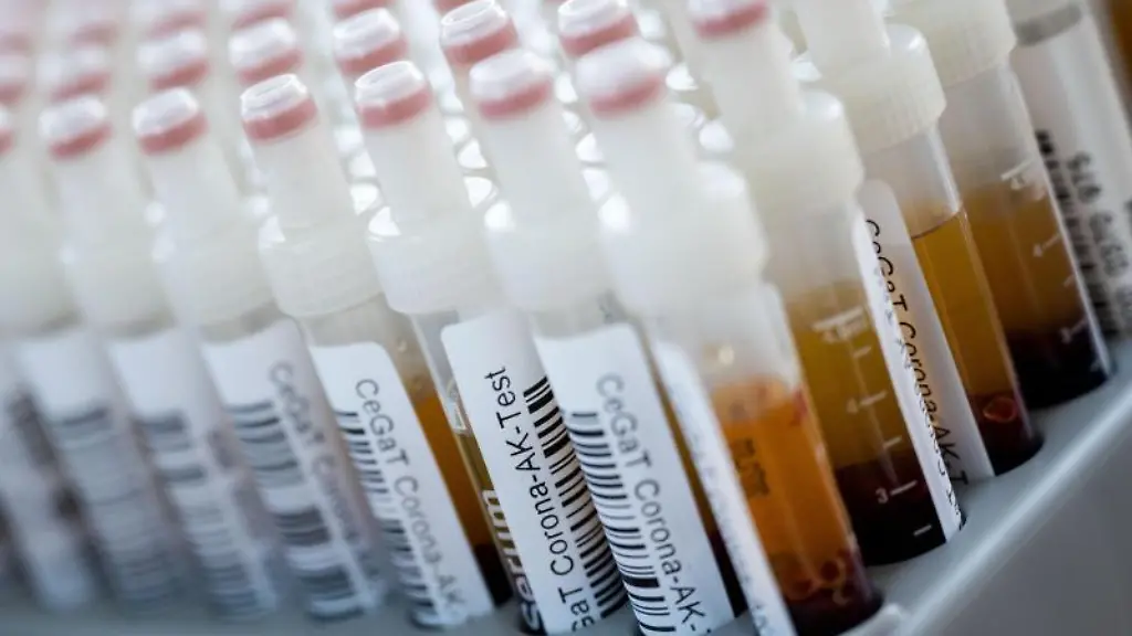 Blutentnahmeroehrchen-mit-Blutproben-fuer-einen-Corona-Antikoerper-Test