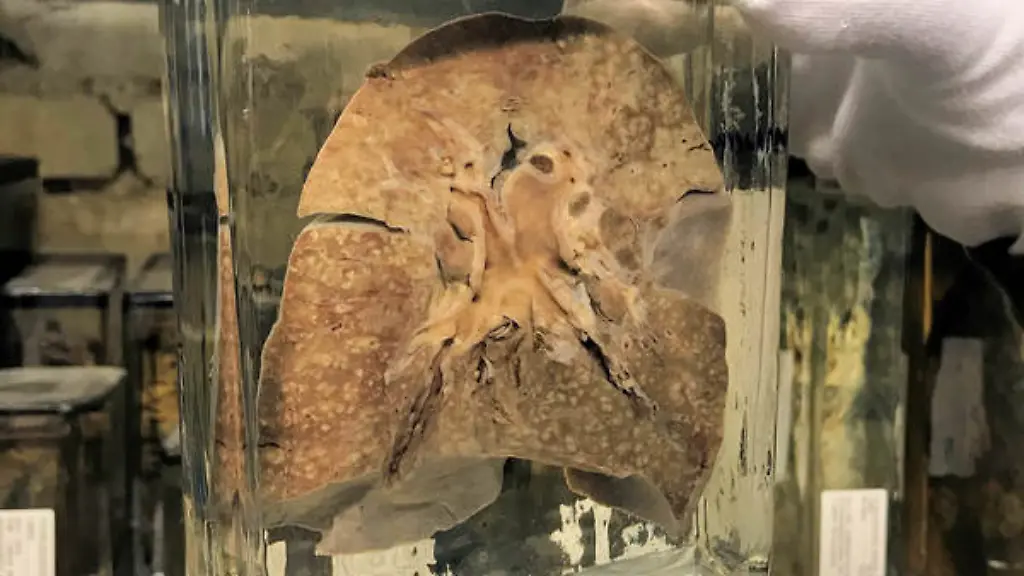 ACHTUNG-Frei-nur-zur-redaktionellen-Verwendung-im-Zusammenhang-mit-der-Berichterstattung-ueber-die-Studie