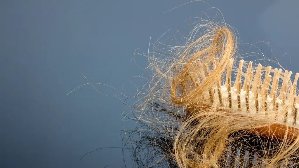 Haarbuerste-mit-Haare-Eine-Haarbuerste-mit-Haeren-Beginn-von-Haarausfall-und-Alopezie-Copyright-xZoonar
