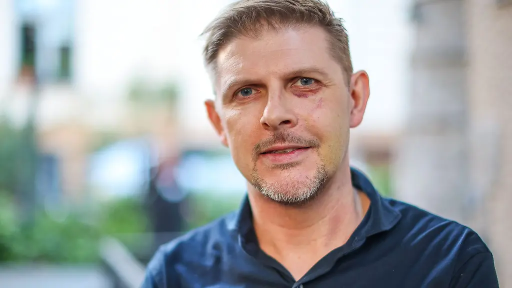 Matthias-Ecke-SPD-wurde-am-3-Mai-2024-beim-Aufhaengen-von-Wahlplakaten-angegriffen