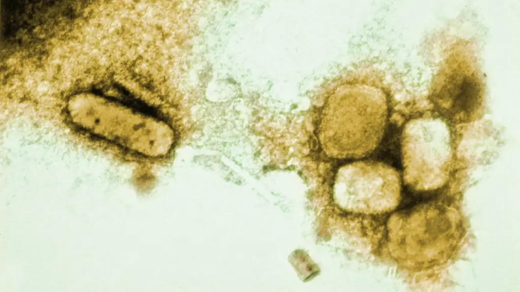 EM-image-variola-smallpox-viruses