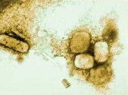 EM Image Variola Smallpox Viruses