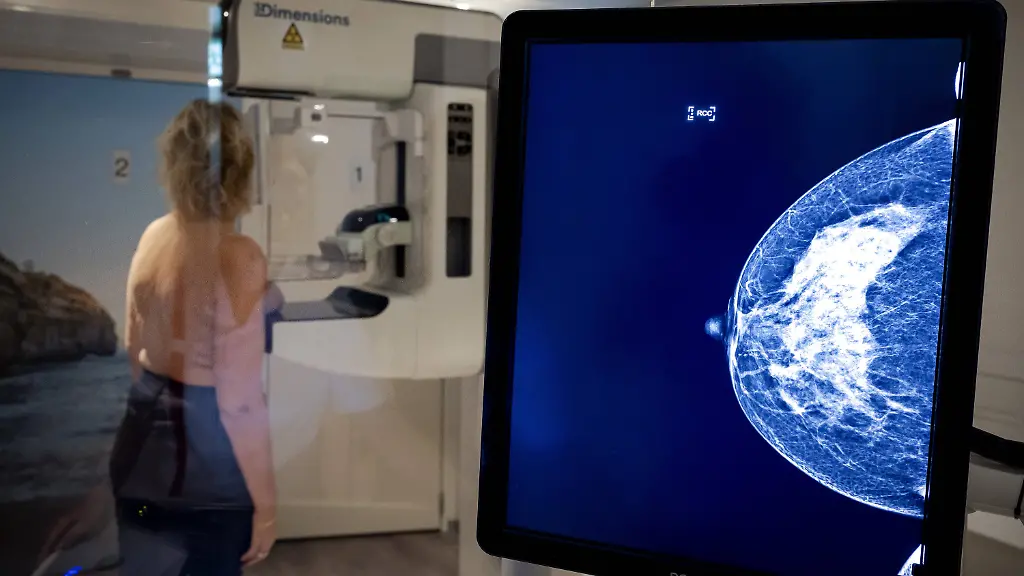 ILLUSTRATIVE-Mammographer-with-client-during-a-breast-cancer-examination-by-an-employee-of-Population-Research-Netherlands-ANP-ROBIN-VAN-LONKHUIJSEN-netherlands-out-belgium-out-PUBLICATIONxINxGERxSUIxAUTxONLY-Copyright-xx-x485029312x-originalFilename-485029312