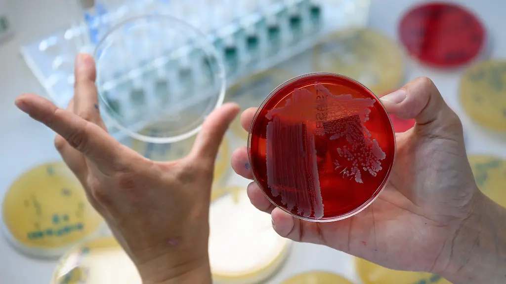 Im-Labor-der-Landesuntersuchungsanstalt-in-Chemnitz-werden-Bakterien-aus-Lebensmittelproben-analysiert