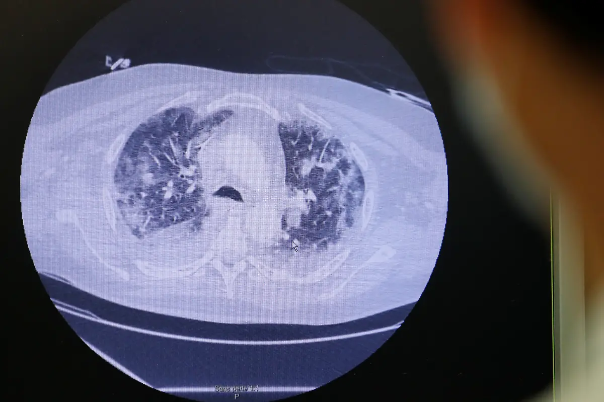 2020-05-07T000000Z-1707276091-RC2QJG9KEN5M-RTRMADP-3-HEALTH-CORONAVIRUS-FRANCE-HOSPITAL