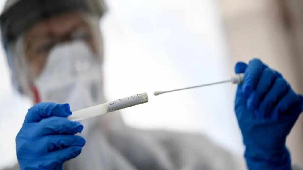 Eine-Mitarbeiterin-vom-Gesundheitsamt-haelt-einen-Abstrichstaebchen-in-der-Hand