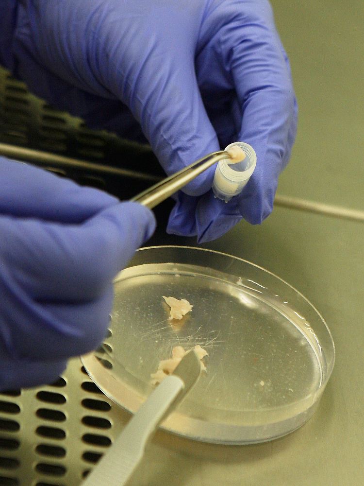 In Belgien wurde weltweit die erste erfolgreiche Transplantation von Eierstockgewebe bei Zwillingsschwestern vorgenommen.