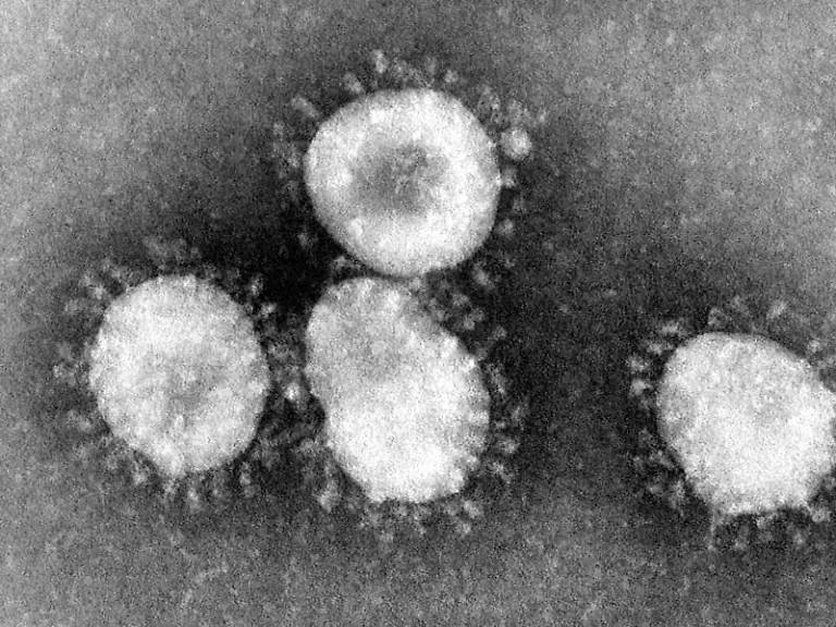 Ein-Coronavirus-unter-dem-Mikroskop