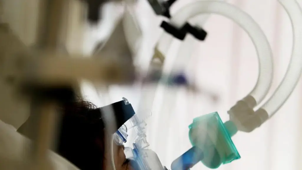 Ein-Patient-wird-auf-der-Intensivstation-beatmet