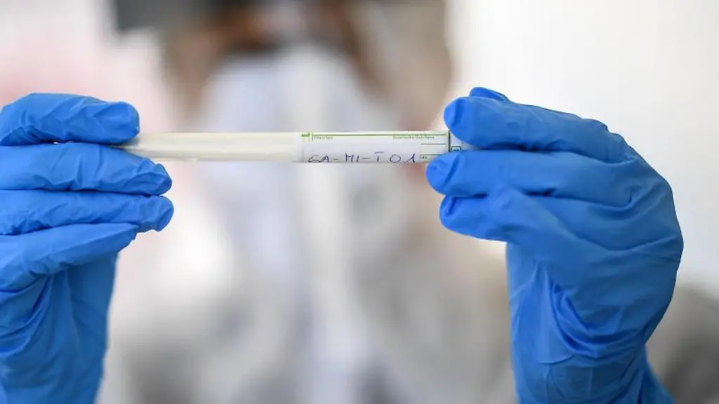 Proben-werden-auf-das-Coronavirus-in-einem-Labor-getestet