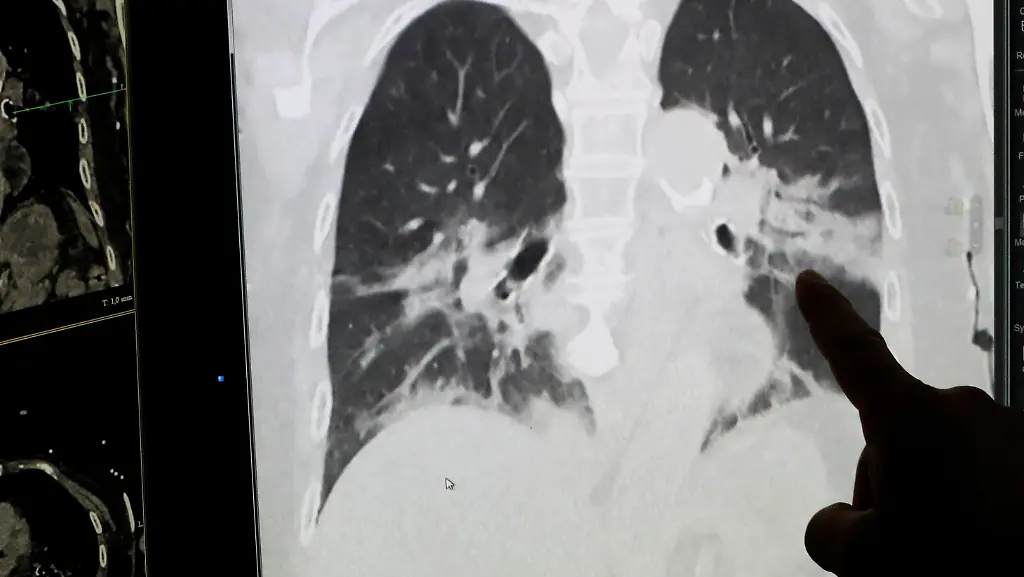 9a700512fda302ed5fc8d44944f3b6c3