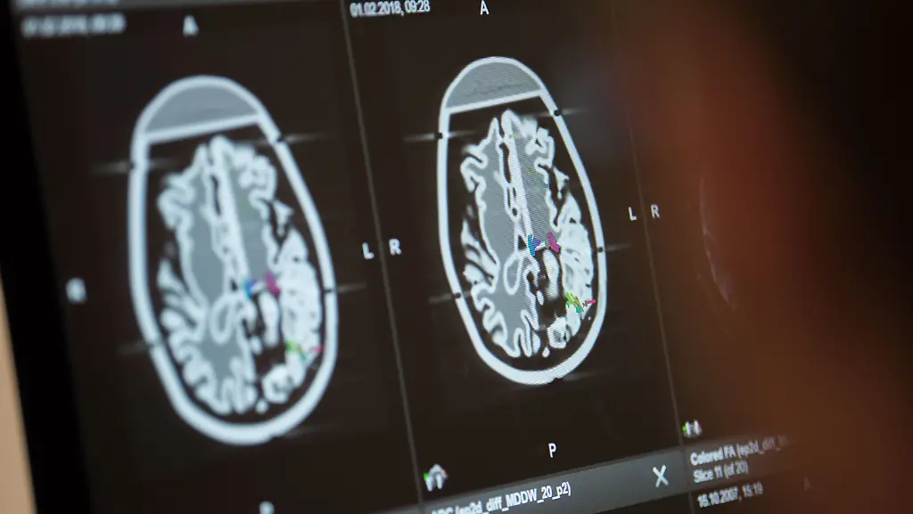 4acd7b5d8338d81d6c8b5930c0a85924