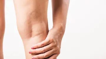 Welt-Thrombosetag
