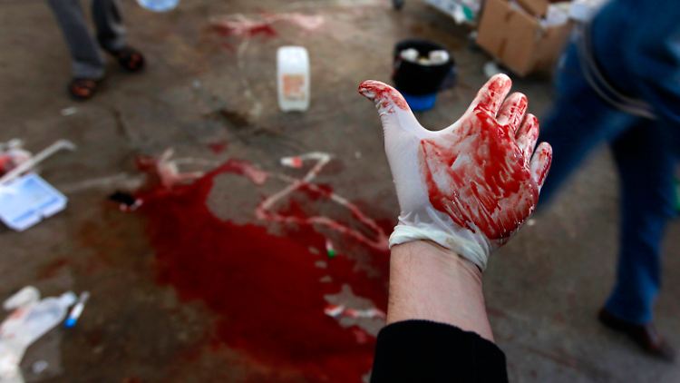 Die Hand eines Arztes in einem Krankenhaus in Misrata.