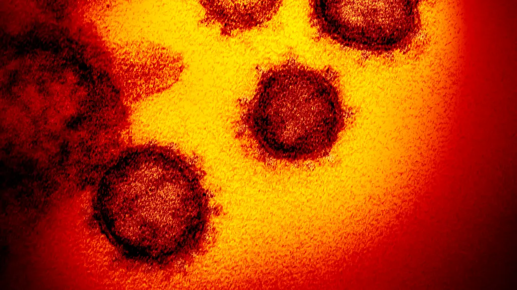 d27fa4fa20853b82d6aaa29a72f6a4c3