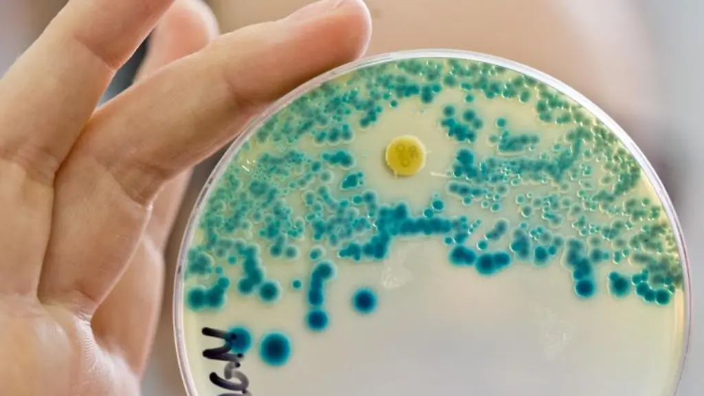 Eine-Indikatorkulturplatte-zum-Nachweis-von-resistenten-Bakterien