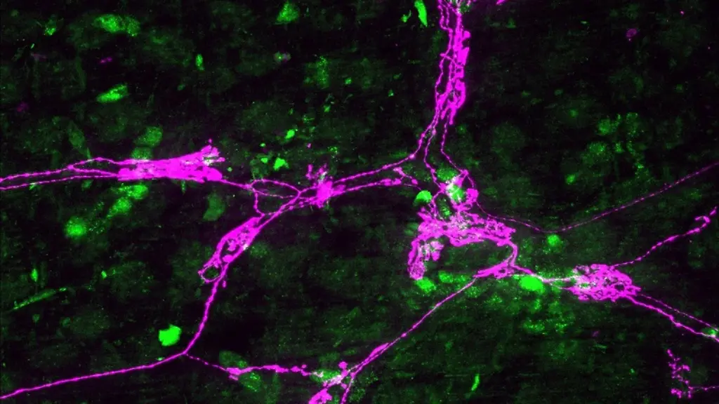 ACHTUNG-Frei-nur-im-Zusammenhang-mit-der-Berichterstattung-ueber-die-Studi