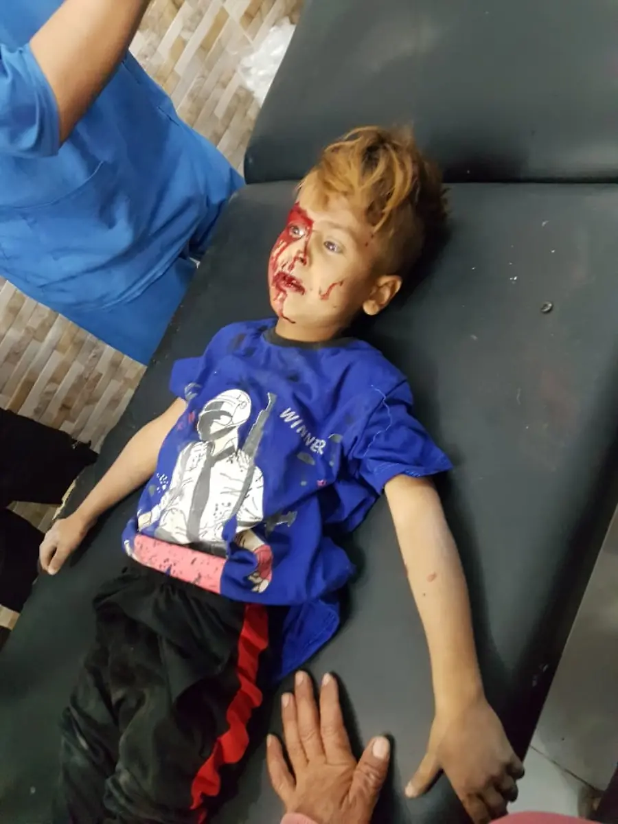 13-10-attacke-auf-civilisten-convoy-be-Ras-Al-Ain