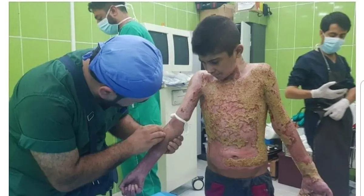 15-10-Tal-Tamr-krankenhaus-kind-aus-Ras-Al-Ain