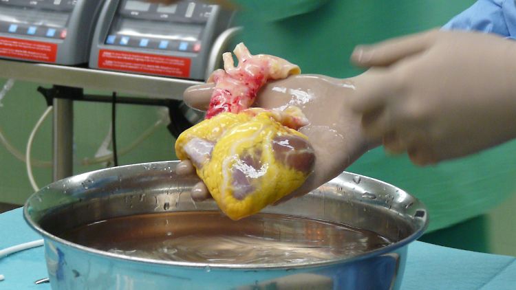 Ein Spenderherz. Es gibt zu wenig Transplantationsorgane.