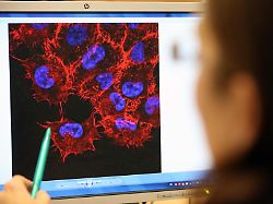 Zweifel an Aussagekraft: Neue mRNA-Impfung halbiert laut Studie Hautkrebs-Rückfallrisiko