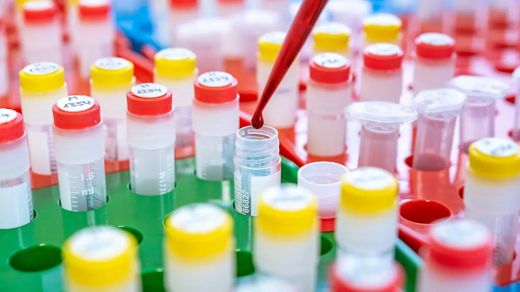 20190218-Foto-Labor-Quelle-Universitaetsklinikum-Heidelberg-1