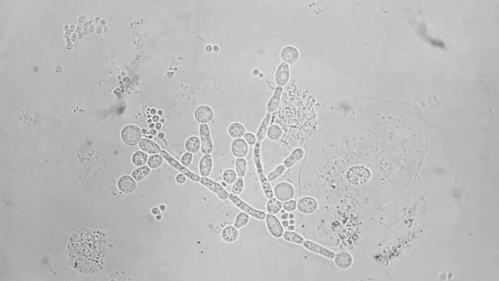 Candida-albicans-sputum
