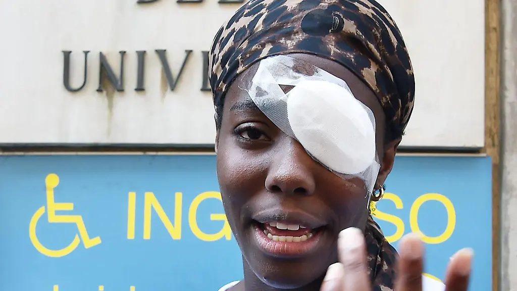 Osakue-war-am-vergangenen-Montagabend-in-der-Naehe-von-Turin-aus-einem-fahrenden-Auto-mit-einem-Ei-beworfen-worden-Sie-musste-in-einer-Klinik-am-Auge-behandelt-werden