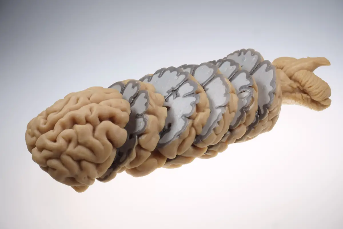 04-gehirnmodell