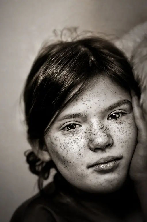 frecklesatlantajordan