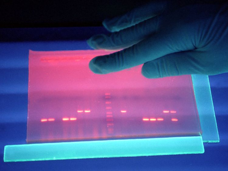 Untersuchung von fluoreszierender DNS von EHEC-Bakterien in einem Labor des Robert-Koch-Instituts.
