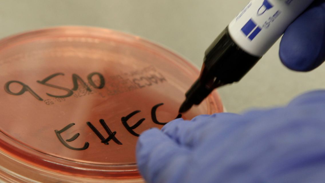 Eine EHEC-Bakterienkultur wird im mikrobiologischen Labor des Universitaetsklinikums Eppendorf in Hamburg beschriftet.