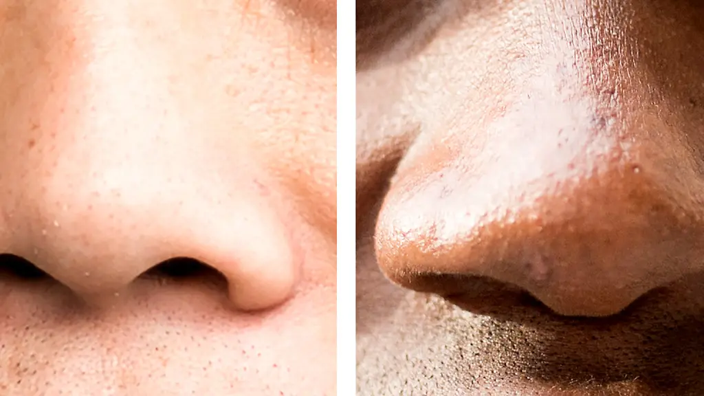 f65935637b878f622f323e038ab3958c