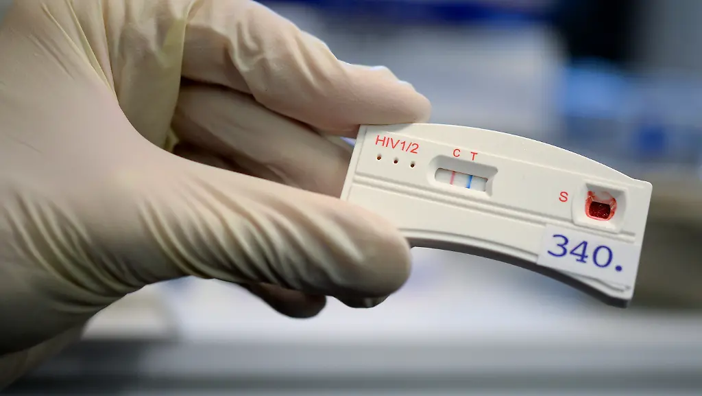 ARCHIV-Der-Teststreifen-an-einem-HIV-Schnelltest-verfaerbt-sich-am-15-11-2016-in-Berlin-bei-der-Berliner-Aids-Hilfe-e-v-nach-der-Anwendung-mit-dem-Blut-eines-jungen-Mannes-Eine-Frau-fordert-vor-dem-Oberlandesgericht-Muenchen-Bayern-160-000-Euro-Schmerzensgeld-von-dem-Mann-der-sie-mit-HIV-angesteckt-haben-soll-Das-Oberlandesgericht-verkuendet-am-08-02-2017-sein-Urteil-im-Zivilprozess-um-die-HIV-Infektion
