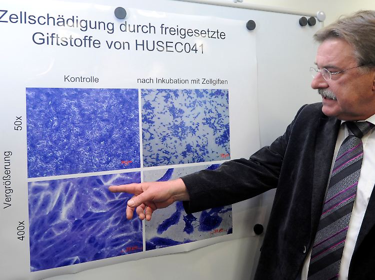 Der Direktor des Instituts für Hygiene des Universitätsklinikums Münster, Helge Karch, erläutert Zellschädigungen durch freigesetzte Giftstoffe des EHEC-Erreger HUSEC041.