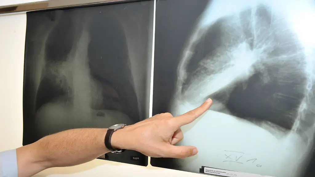 2777ef99a465f56fe6f86dac369251ab