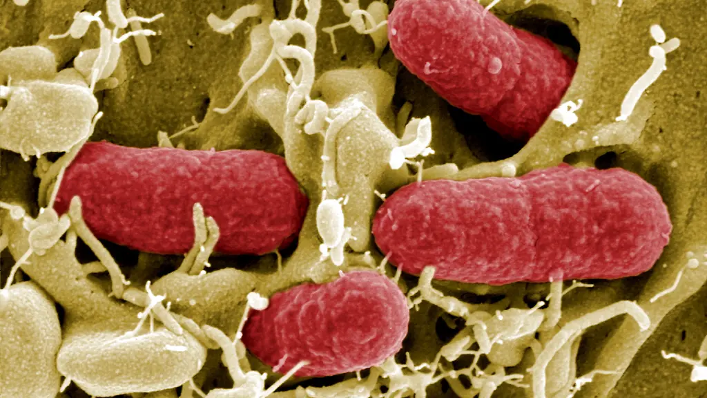 97750c5fc63ad96e1811f6deb58af4f5