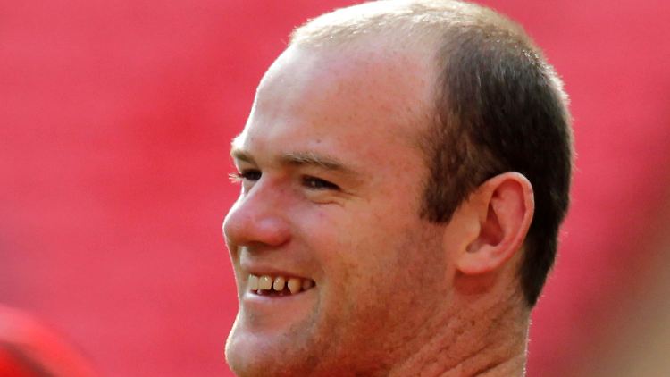 Rooney vor seinem Eingriff.