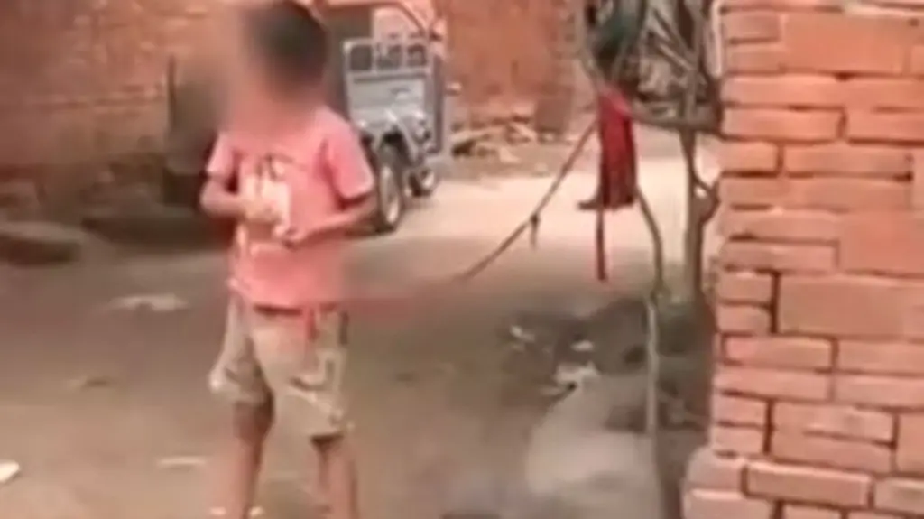 Die-8-Jaehrige-wird-von-ihren-Grosseltern-immer-wieder-an-die-Leine-gelegt-Die-Familie-kann-sich-eine-Behandlung-im-Krankenhaus-nicht-leisten